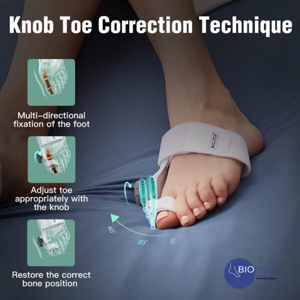 TechLove Bunion Corrector Per Pc X1 Online Shopping Dubai, UAE Linkarta