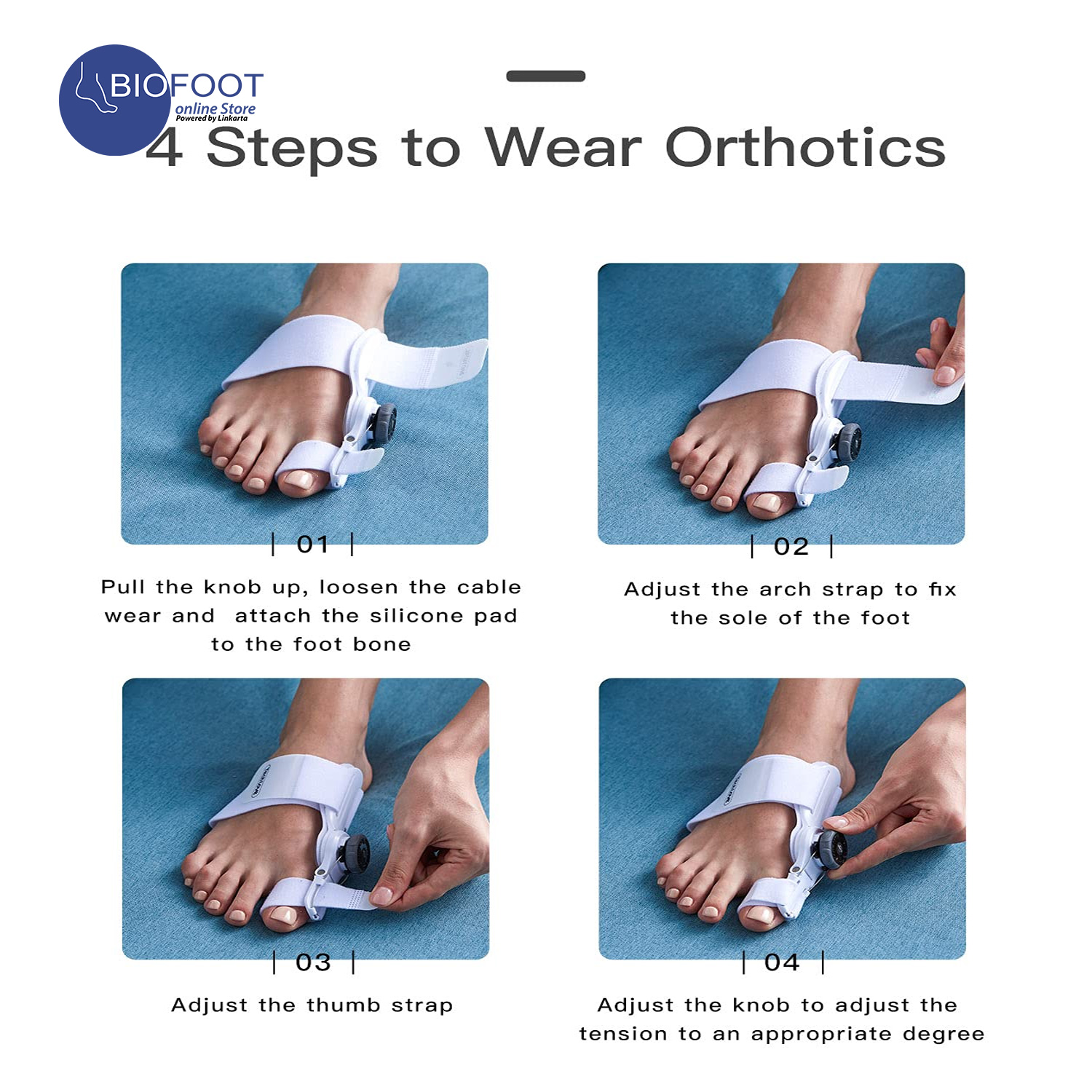 Arch Support Bunion Brace – Alpha Orthotics cures bunion pain with
