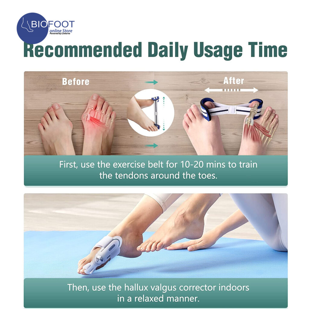 TechLove Tenicore Bunion Corrector XHWM Per Pc Online Shopping Dubai