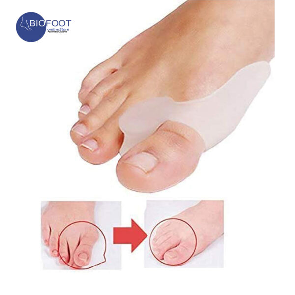 BIOFOOT Silicone Gel Bunion Relief Toe Separator - Cushioned Support for Hallux Valgus & Crooked Toes - Reusable Big Toe Spreader (1 Pair, One Size Fits All) - Image 7