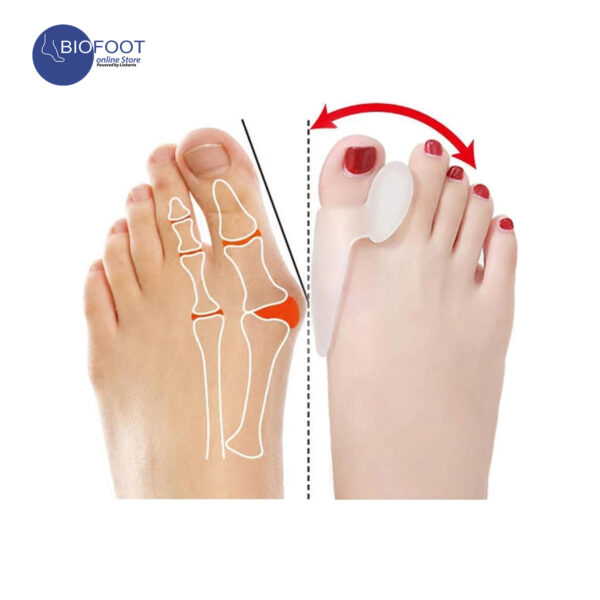 BIOFOOT Silicone Gel Bunion Relief Toe Separator - Cushioned Support for Hallux Valgus & Crooked Toes - Reusable Big Toe Spreader (1 Pair, One Size Fits All) - Image 6