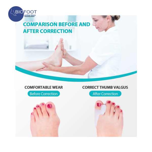 BIOFOOT Silicone Gel Bunion Relief Toe Separator - Cushioned Support for Hallux Valgus & Crooked Toes - Reusable Big Toe Spreader (1 Pair, One Size Fits All) - Image 3