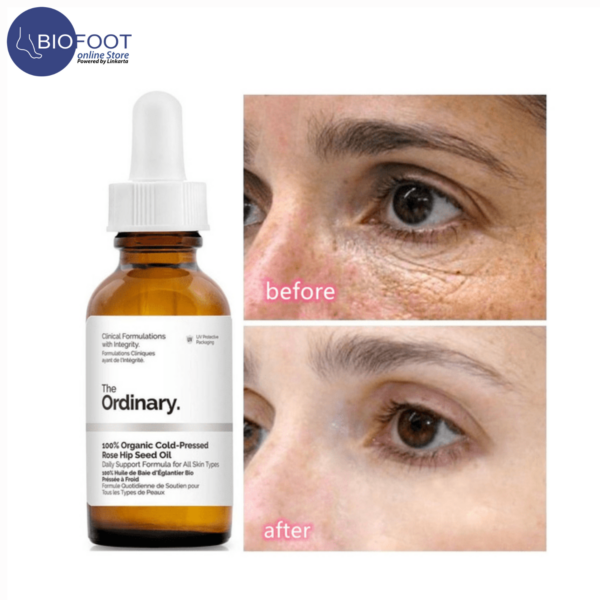 The Ordinary Caffeine Solution 5% + EGCG 30ml - Image 4