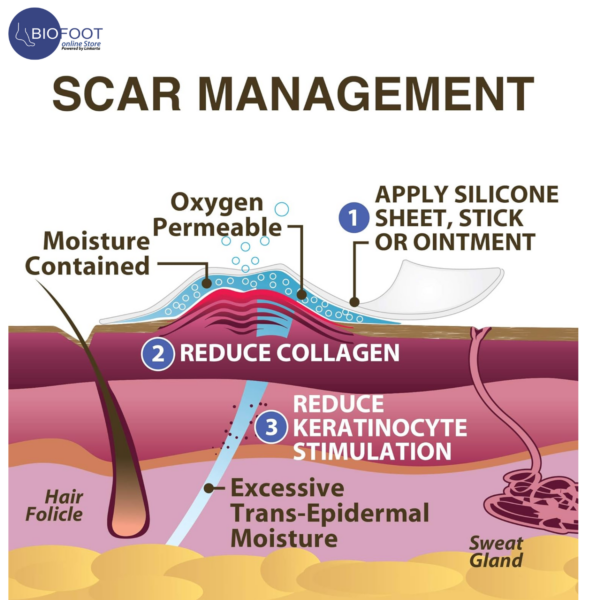 Biodermis Xeragel 100% Silicone Ointment for Scars Clinically Proven to Reduce the Appearance of Old & New Scars 10g - Image 2
