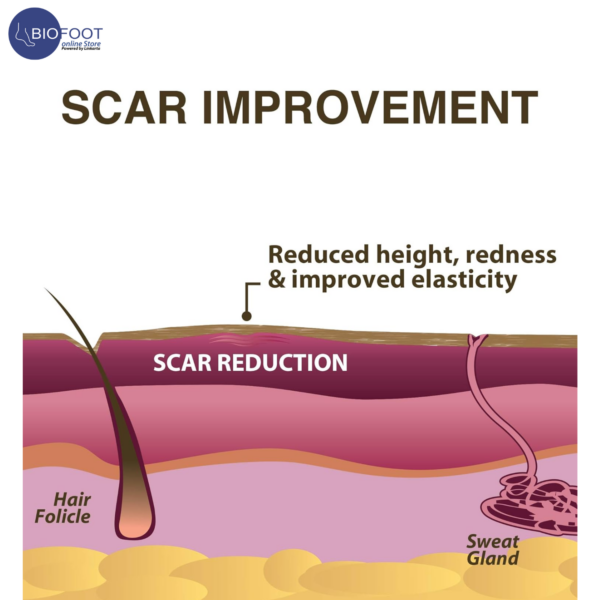 Biodermis Xeragel 100% Silicone Ointment for Scars Clinically Proven to Reduce the Appearance of Old & New Scars 10g - Image 3