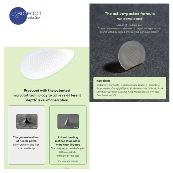 Eldeen Microdart Project, Good Bye Clear Patch, Good Bye Blemishes - Image 2