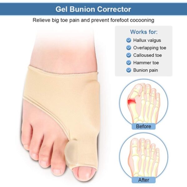 BIOFOOT Double Cushioning Bunion Protector & Corrector Sleeve with Silicone Gel Pads Toe Straightener for Hallux Valgus, Blisters, Crooked & Overlapping Toes | Pain Relief | 1 Pair - Image 3