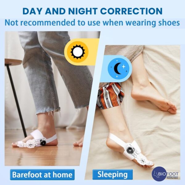 BIOFOOT Micro Adjustable Dial 2024 Orthopedic Bunion Corrector with & Silicone Pad, Big Toe Straightener & Separator, Hallux Valgus Brace for Bunion Pain Relief, 1pc (Left/Right) - Image 8