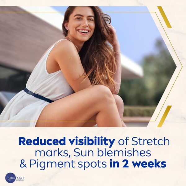 NIVEA LUMINOUS 630 Marks and Spots Reduction Body Cream, Even Skin Tone, Reduced Visibility of Stretch Marks, Sun Blemishes and Pigment Spots, 48H Moisture, Clinically Proven, 200ml - Image 2
