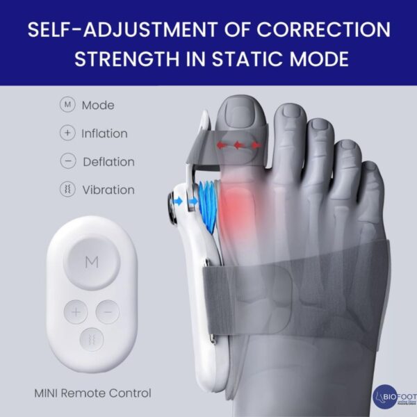 Electric Bunion Corrector, Wireless Big Toe Straightener | 5 Smart Dynamic Air Pressure Training Modes for Hallux Valgus, Adjustable Orthopedic Bunion Brace, Hammer Toe Splint for Pain Relief, 1pc L/R, 500mAh Battery | MONE CorrStage Pro-21-A - Image 5